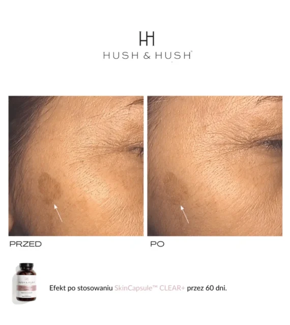 Hush & Hush® • Skin Capsule Clear+ • Wegański suplement diety wspierający skórę w przebiegu trądziku • 60sz - obrazek 6