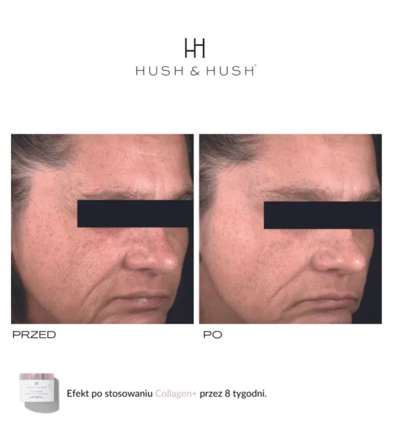 Hush & Hush® • Collagen+ • Suplement diety z wegetariańskim kolagenem wzmacniający skórę, włosy, mięśnie, stawy • 90g/30 porcji - obrazek 6