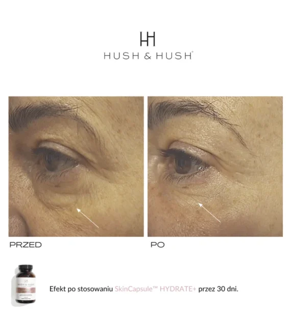 Hush & Hush® • Skin Capsule Hydrate+ • Wegański suplement diety poprawiający poziom nawilżenia skóry • 60szt - obrazek 6