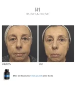 Hush & Hush® • Time Capsule • Suplement diety przeciwstarzeniowy i antyoksydacyjny • 60szt - obrazek 4