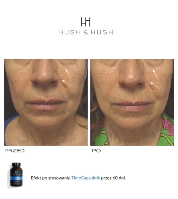 Hush & Hush® • Time Capsule • Suplement diety przeciwstarzeniowy i antyoksydacyjny • 60szt - obrazek 5