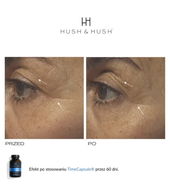 Hush & Hush® • Time Capsule • Suplement diety przeciwstarzeniowy i antyoksydacyjny • 60szt - obrazek 6