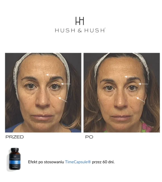 Hush & Hush® • Time Capsule • Suplement diety przeciwstarzeniowy i antyoksydacyjny • 60szt - obrazek 7